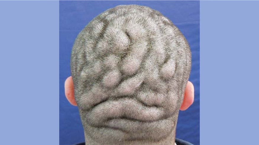 Brain Scalp Final.jpg